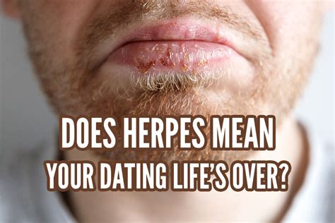 dating with herpes 1